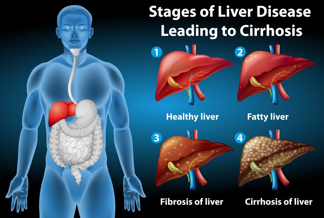 LIVER DISEASE TESTS IN YELAHANKA